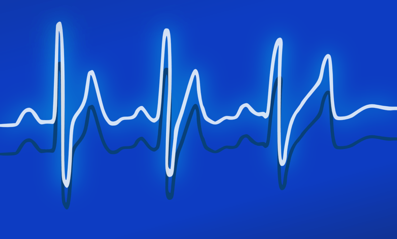 عملية استخلاص الإشارة – Demodulation Process