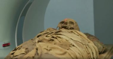 قمل الرأس فى المومياوات يكشف أسرارا غير متوقعة