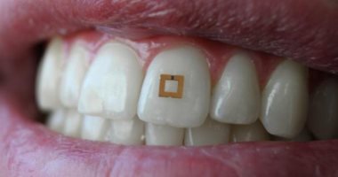 إبتكار سينسور صغير يمكنه مراقبة طعامك.. اعرف التفاصيل