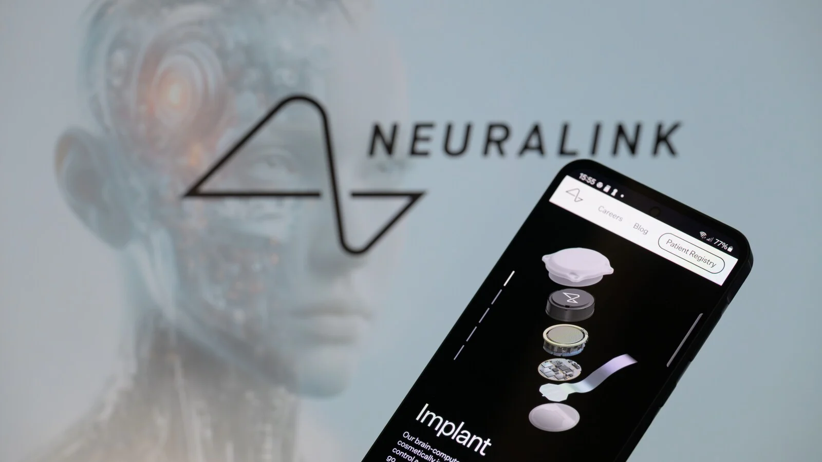 ١٢ شخصًا حصلوا الآن على زراعة دماغية من Neuralink من إيلون ماسك