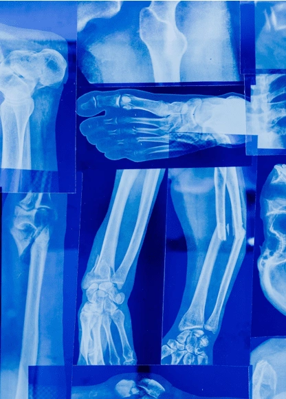 الذكاء الاصطناعي والأجهزة المتقدمة يحولان التصوير الطبي في 2026: تشخيص أسرع وتعرض إشعاعي أقل