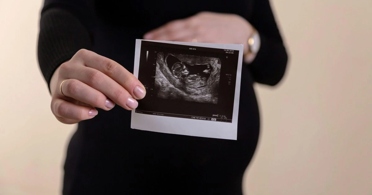 DopFone: New App Turns Smartphones Into Medical-Grade Fetal Heart Monitors