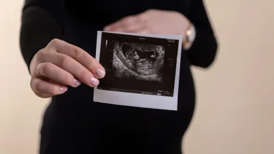 تطبيق DopFone: باحثون يحولون الهواتف الذكية إلى أجهزة رصد لنبض الجنين بدقة طبية