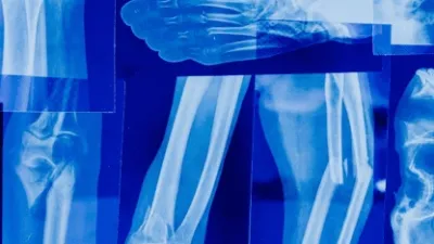 AI and Advanced Hardware Transform Medical Imaging in 2026: Faster Diagnosis, Lower Radiation Exposure