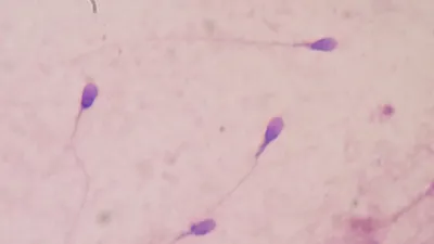 Paterna Biosciences Lab-Grown Sperm Could Revolutionize Male Fertility Treatments