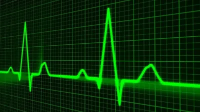 كاشف ذو حلقة مغلقة – Phase Lock Loop FM Demodulation