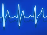 عملية استخلاص الإشارة – Demodulation Process