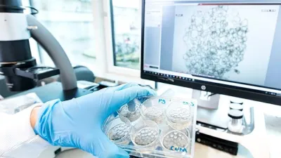 Automated Organoid Culture Platform – Revolutionizing 3D Tissue Research