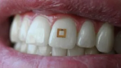 إبتكار سينسور صغير يمكنه مراقبة طعامك.. اعرف التفاصيل