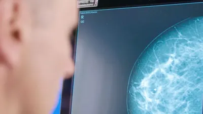 الذكاء الاصطناعي يكتشف مخاطر أمراض القلب الخفية أثناء تصوير الثدي بالأشعة