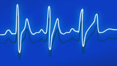 النطاق الجانبي المزدوج المكبوت – DSBSC