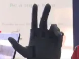 يعنى إيه ذراع إلكترونية؟ وكيف يضاف الإحساس إلى الأطراف الصناعية؟