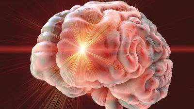 Scientists Reverse Stroke Paralysis in Breakthrough Stem Cell Study