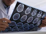 Metamaterial MRI Antenna Unlocks Stunningly Clear Images of the Eye and Brain