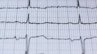 نسبة رفض الوضع المشترك – CMRR
